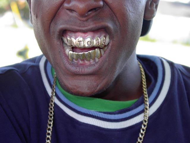 teeth.jpg