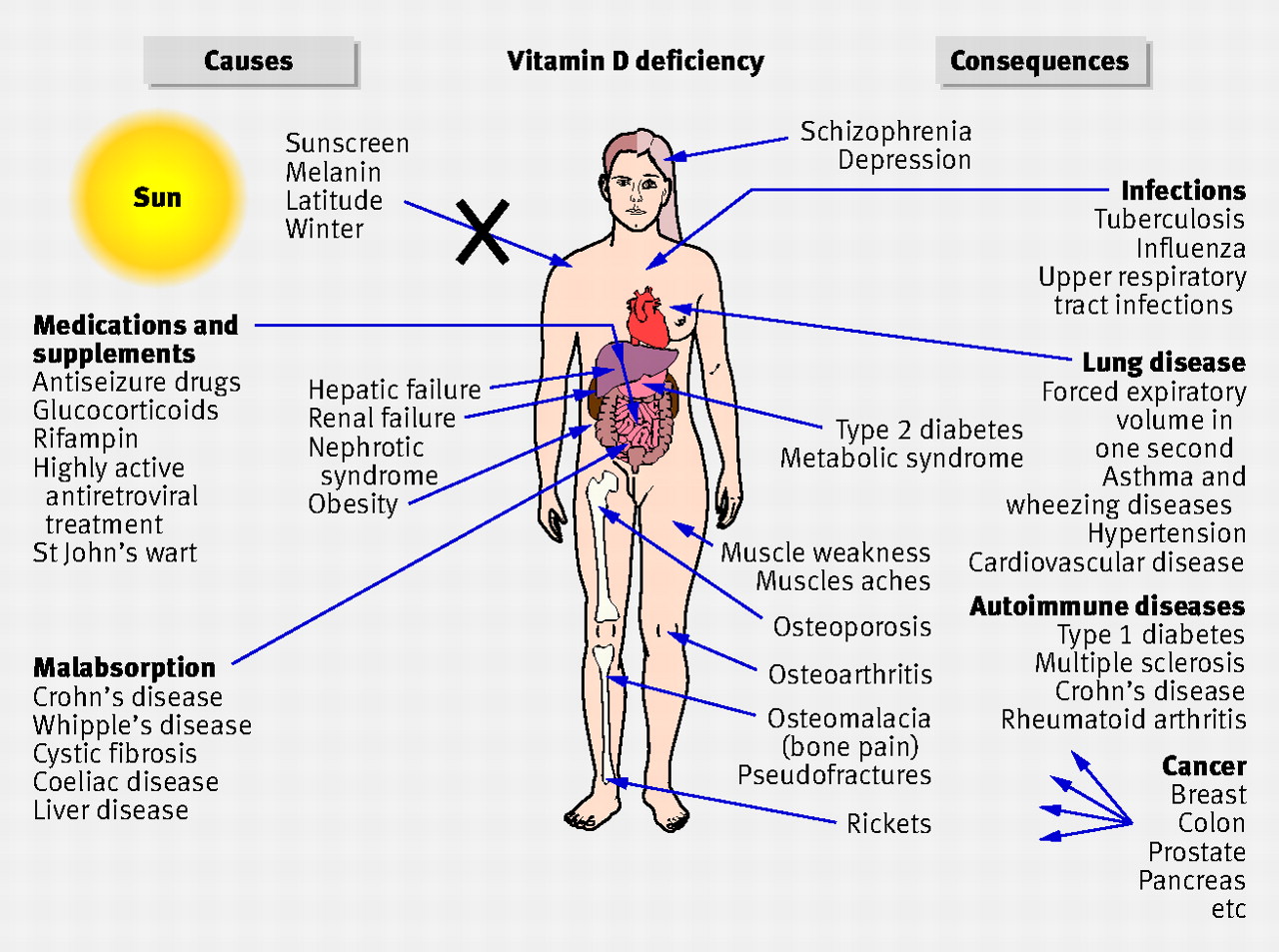 vitamin-d-def.jpg