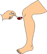 KneeJerk-1.gif