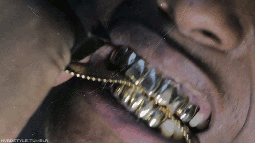 gold-anim.gif