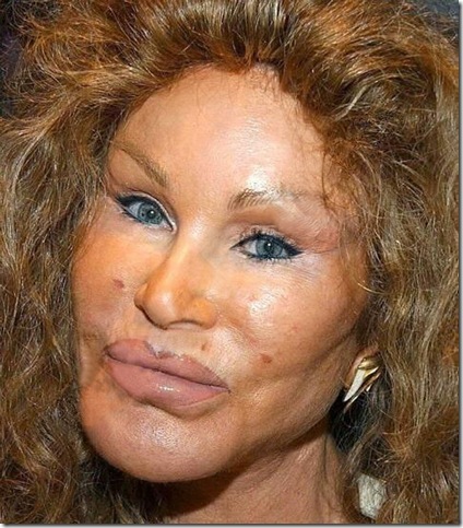 jocelyn_wildenstein.jpg