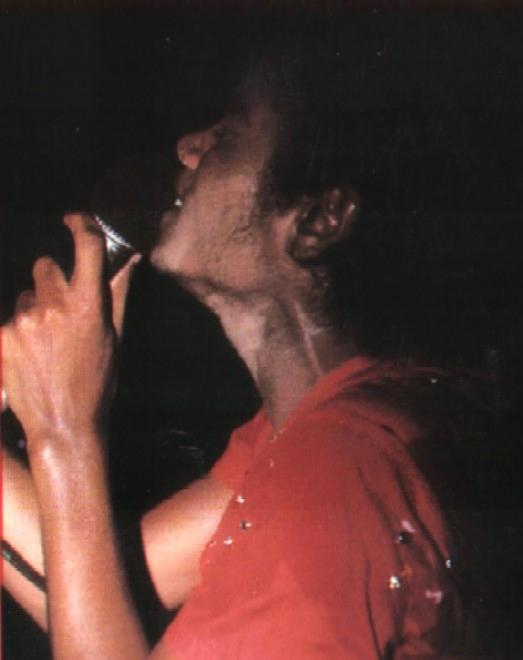 MichaelJacksonVvitiligo.jpg
