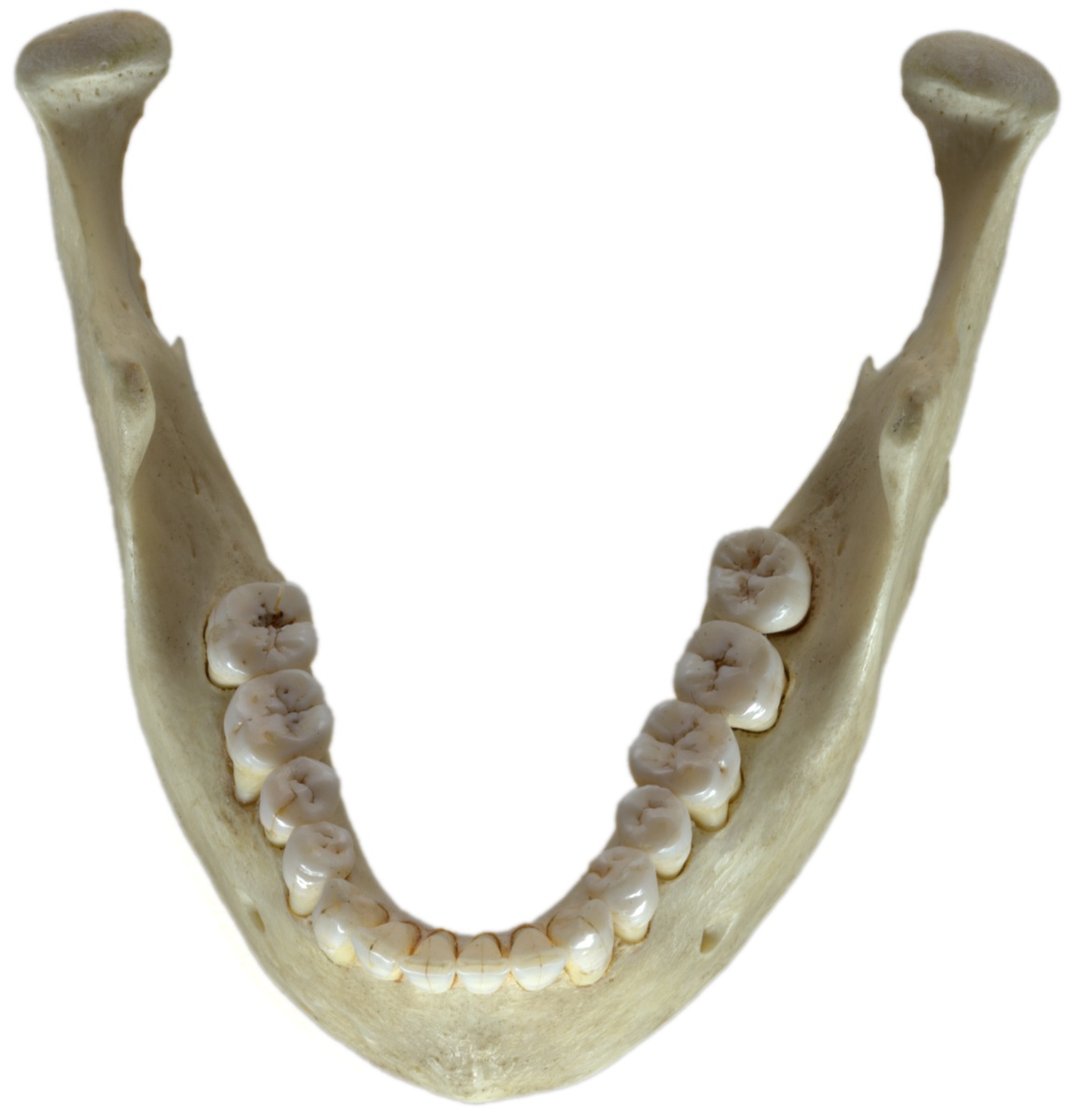 Human_jawbone_top.jpg