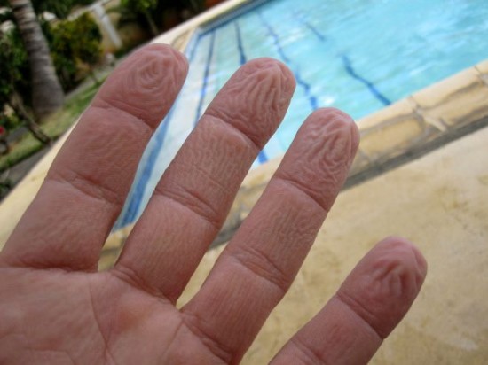 Wrinkled-fingers-550x412.jpg