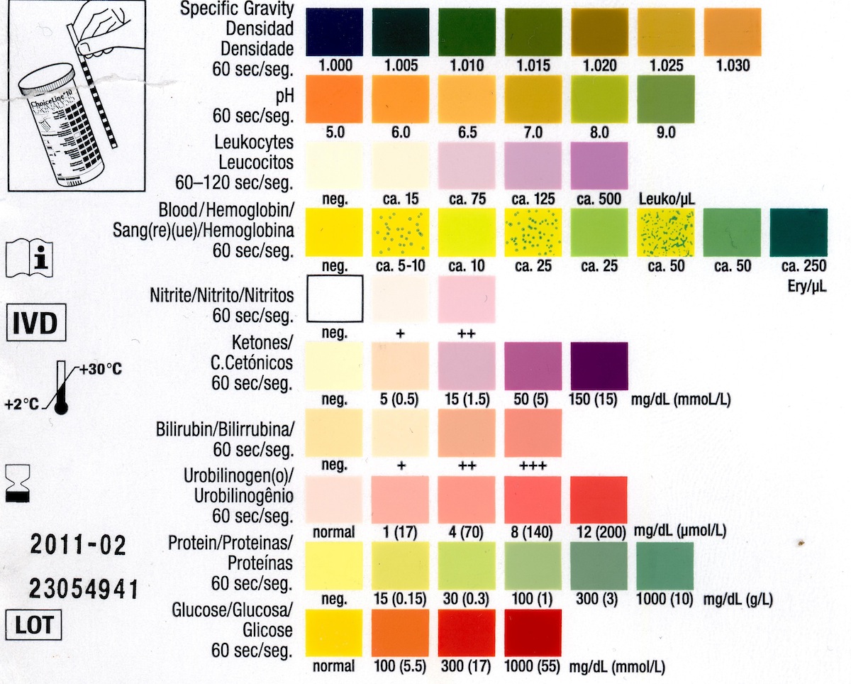 Urinalysis_2.jpg
