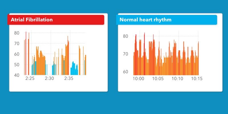 cardiogramalgorithm-800x400.jpg