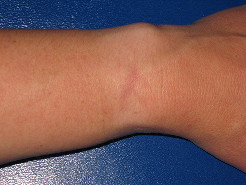 wrist.jpg