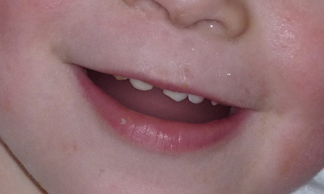 mouth.jpg