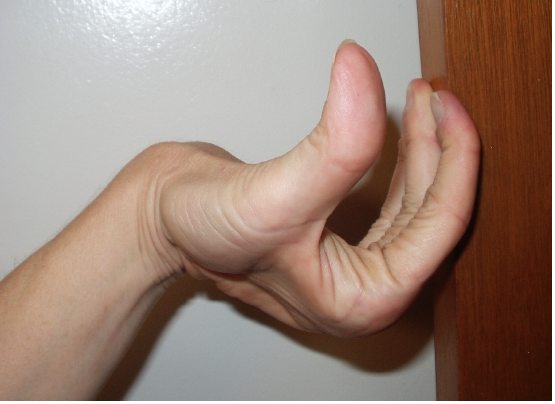 Bent%20Wrist.png