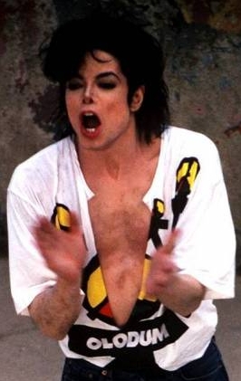 Michael%20Jackson%20Vitiligo%20Chest1.jpg