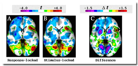 200505brainactivity4.jpg