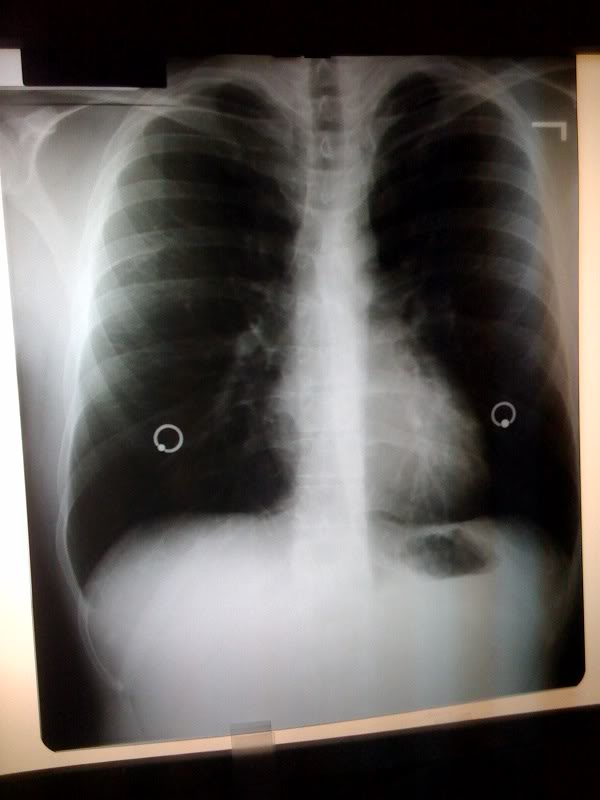 chest.jpg