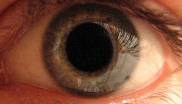 eye-pwm-flicker.gif