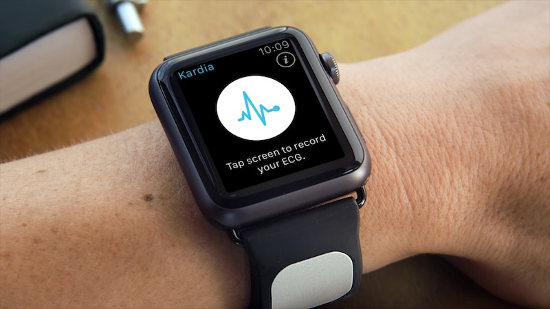 Kardia-Band-apple-watch.jpg