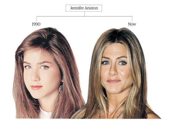 botox-jennifer-aniston-001-jpg.2849005