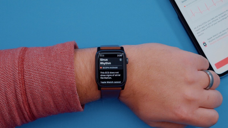apple ecg release