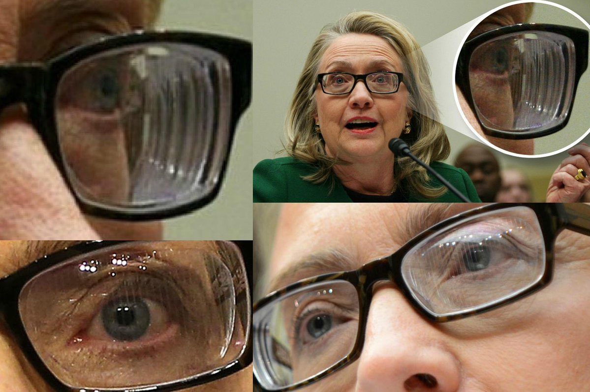 Is Hillary wearing Carl Zeiss brand z1 blue lenses to treat
